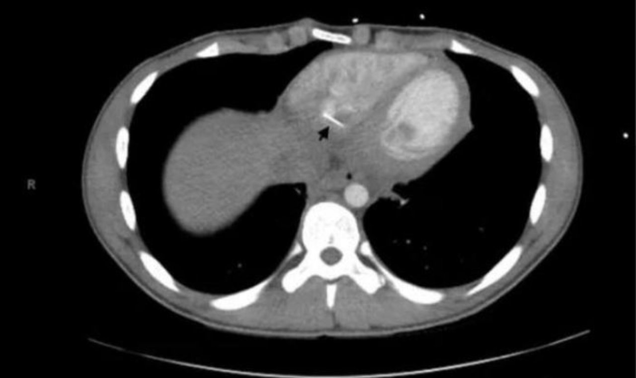 Massachusetts Ago Cuore