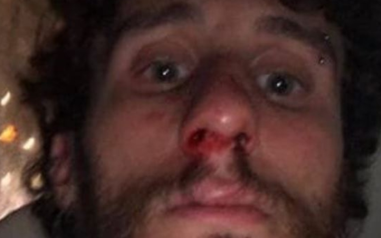 Ragazzo gay picchiato a Napoli (instagram) (1)