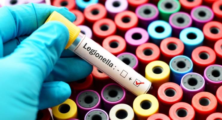 Legionella