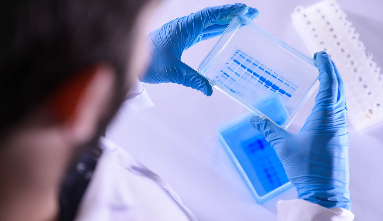 Covid Italia Letalità