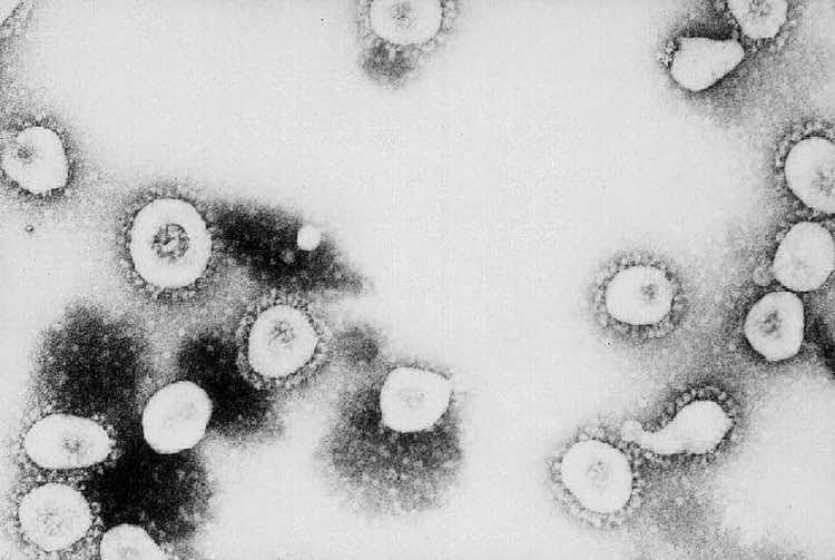 virus covid pandemia