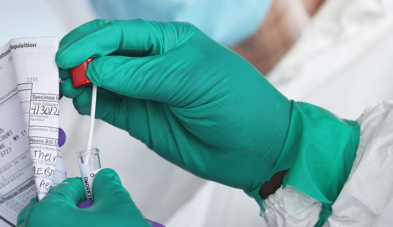 covid, positivo variante inglese