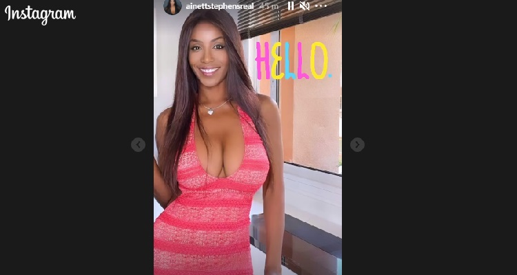 Ainett Stephens sorriso