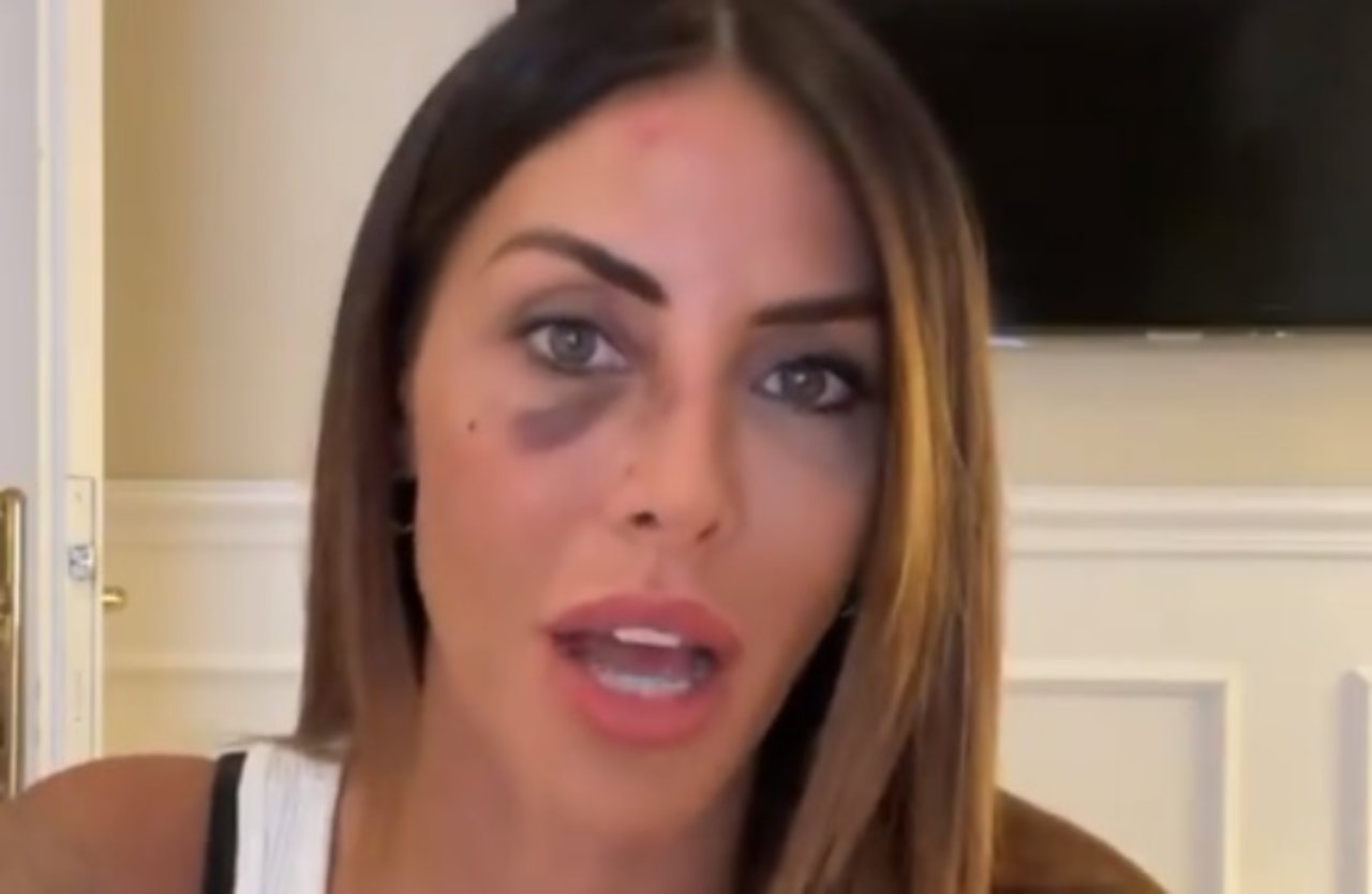 Guendalina Tavassi occhio nero