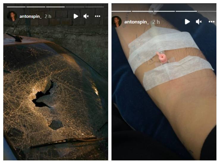 Le storie condivise da Antonino